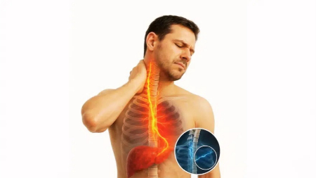 ارتباط کبد چرب و درد گردن؛ نشانه‌ای پنهان از سلامت بدن